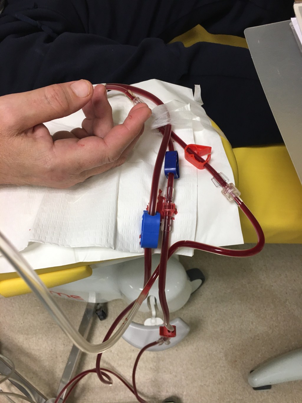 First Patient Monitoring Session: iTrend Project&nbsp;Insights